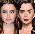 Actress Lily Collins Botox and Lip Filler with Her Before Ad After Photos