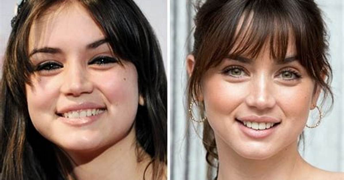 Ana De Armas' Plastic Surgery Journey