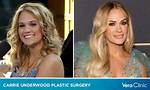Are Carrie Underwood Plastic Surgery Rumors True? the Country Music Singer Addresses the Speculation ·