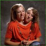 Exploring the Lives of Abby and Brittany Hensel: Are They Still Alive?