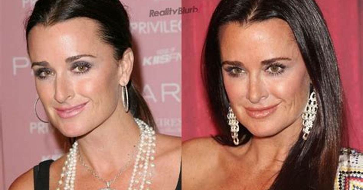Has Kyle Richards Had Plastic Surgery? What the 'Rhobh' Star Has Said |