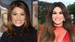 Kimberly Guilfoyle's Face Transformation: Before and After