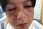 Parents Warned over Dangerous 'Roundabout Challenge' Kids Craze That Can Trigger 'Red-Outs' and Stro |