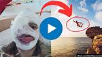 Split Face Diving Accident: the Shocking Story of a Teenagers Near-Fatal Injury