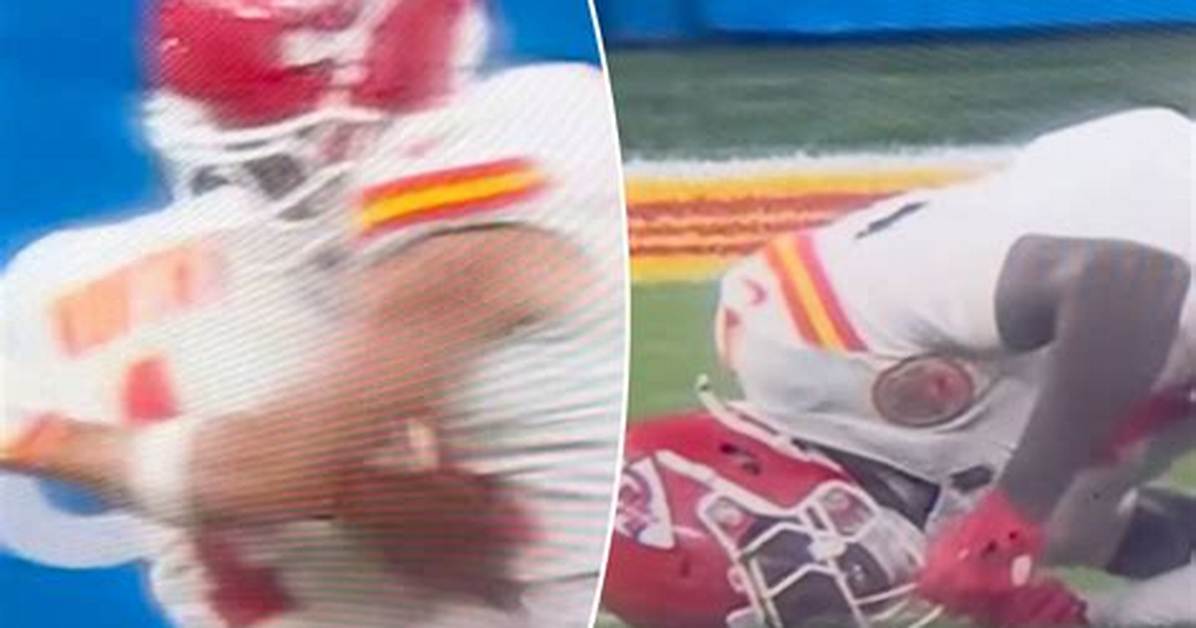 Travis Kelce Injury News: What You Need to Know