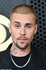 [Ultimate Guide] Justin Bieber's Hairline Secrets Revealed