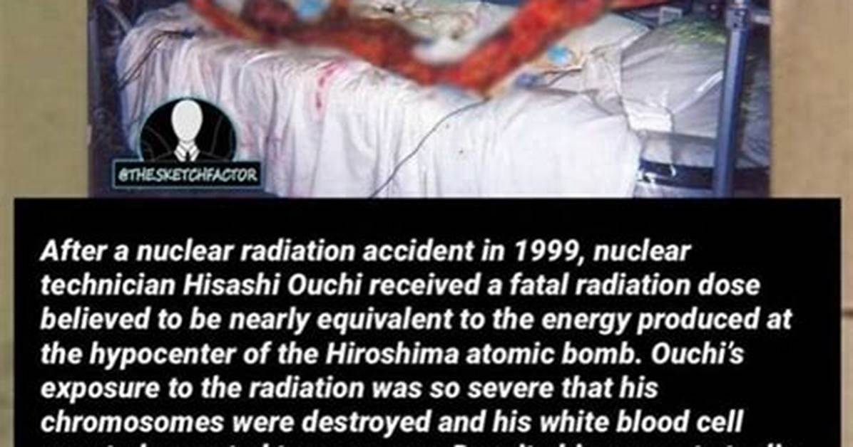 Understanding Ouchi Radiation: the Science Behind a Unique Phenomenon