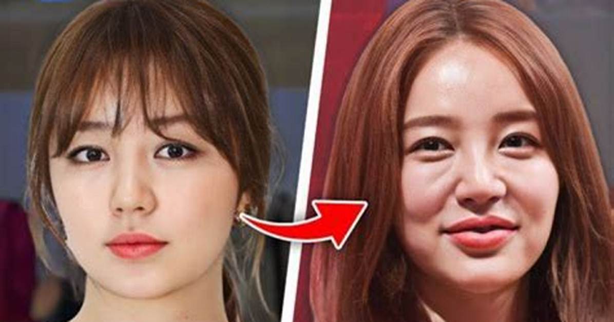 Unveiling the Truth: Do Korean Actors Get Plastic Surgery?