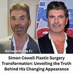 Unveiling the Truth: Does Simon Cowell's Son Have Autism?