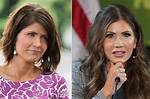 Unveiling the Truth: Kristi Noem Plastic Surgery Before and After